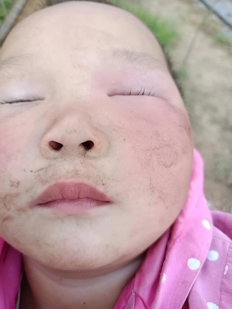 女童被蜜蜂蛰伤致死,被蜜蜂蜇的小孩